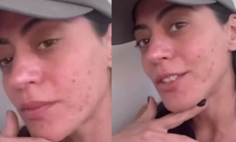 Clarice de 'Garota do Momento', Carol Castro tem doença crônica; médica alerta sobre diagnóstico e cuidados: 'É recomendável evitar...'